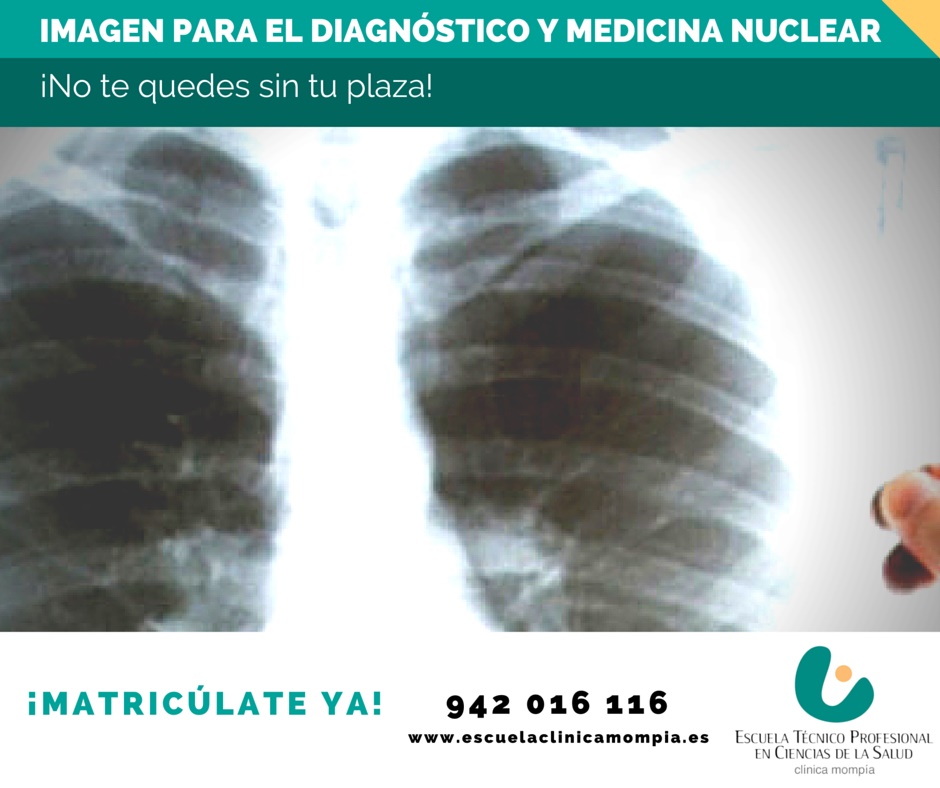 Ya Puedes Matricularte En Imagen Para El Diagnóstico Y Medicina Nuclear